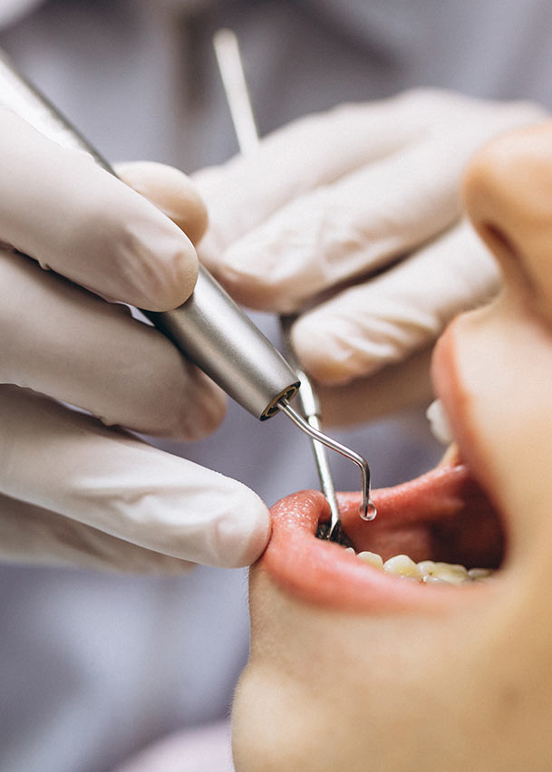 Dental implants