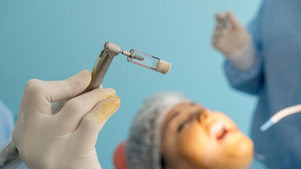 How Long Does Dental Implant Surgery Really Take?