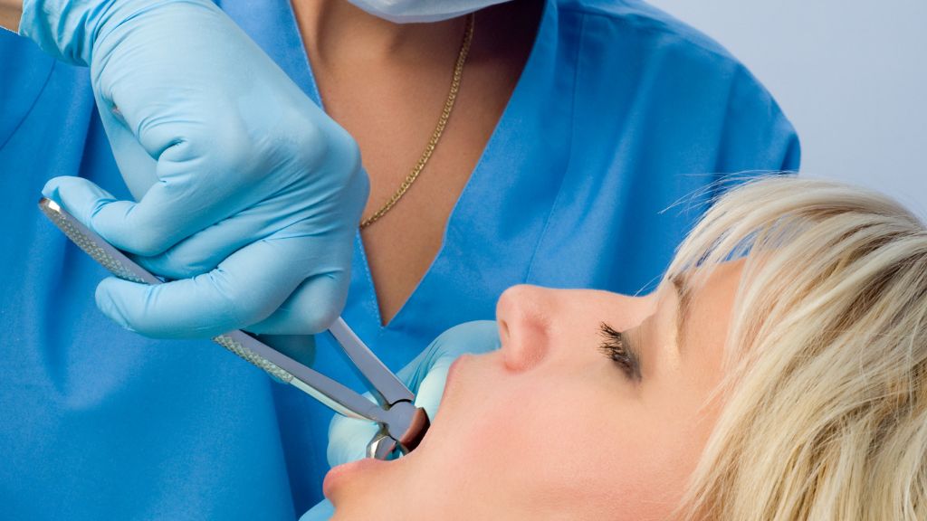 How Painful Is Wisdom Tooth Extraction, Really