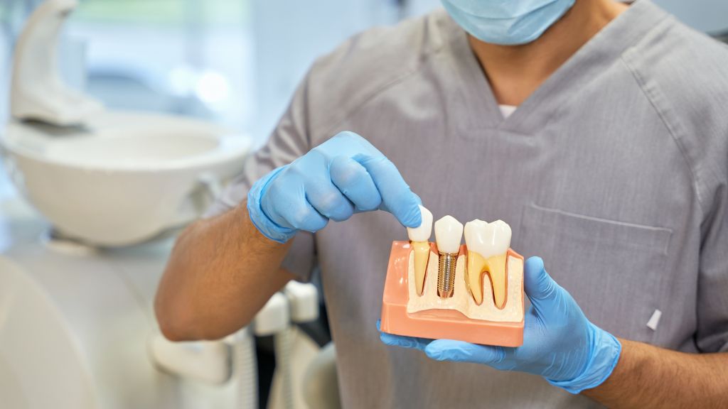 Dental Implant Aftercare: How to Protect Your Investment Long Term