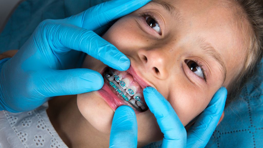 Impacted Canine Tooth: Treatment Options That Pull It Into Place